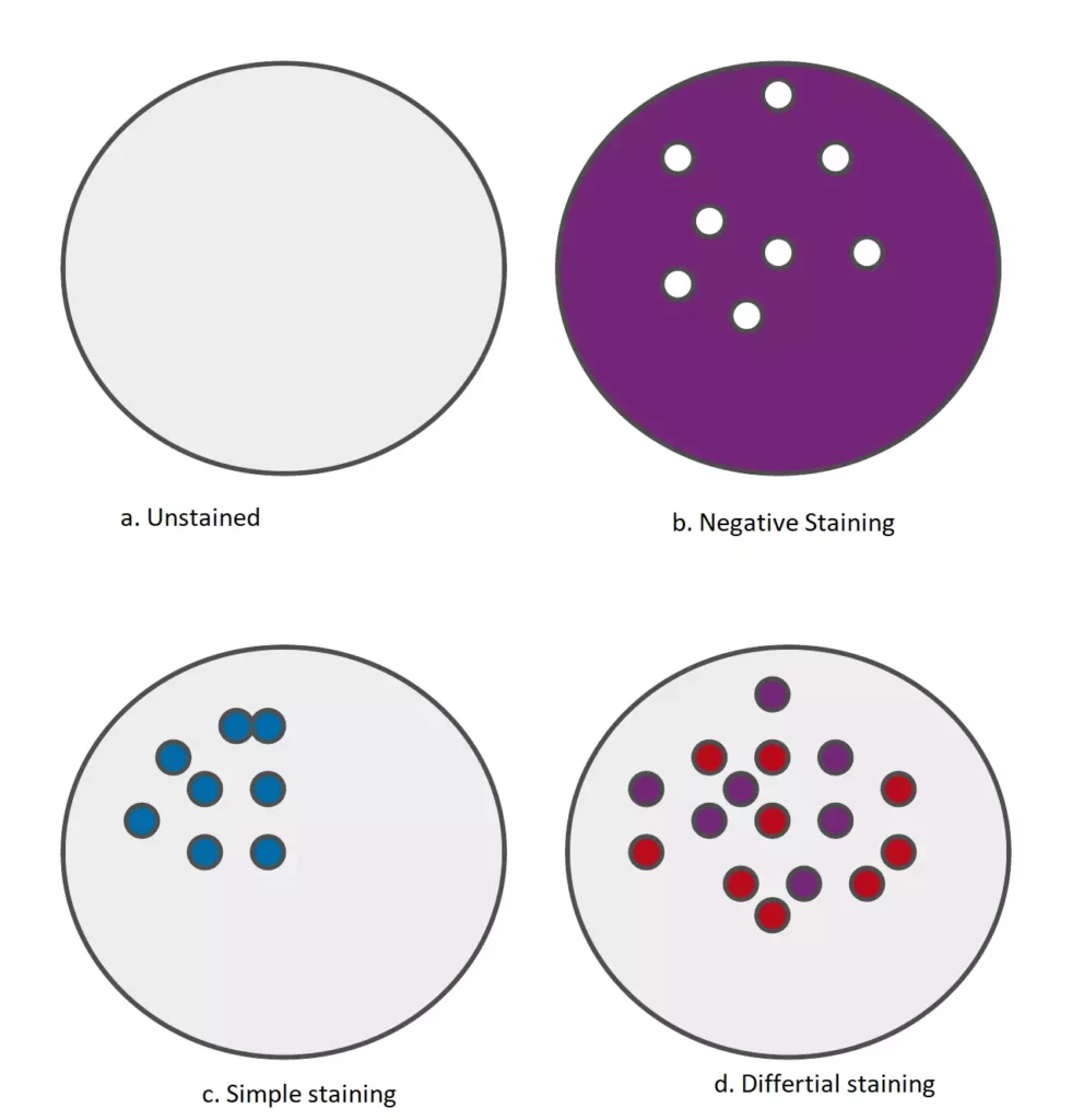 Type of Staining techniques, Microbiology, Negative, Staining, Differential,