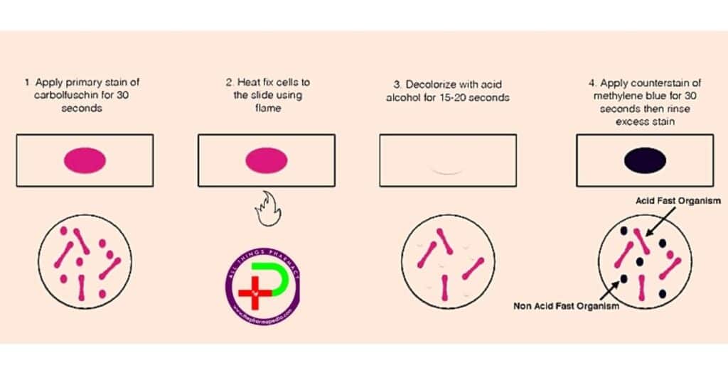 Acid Fast Staining, Procedure, Pharmapedia, The Pharmapedia, Pharmacy Notes