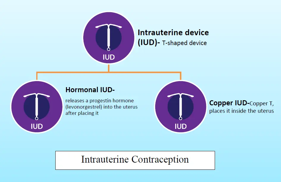 IUD, Intra Uterine Device, Contraceptive, Family planning, Social Pharmacy, Pharmapedia, Pharmacy notes